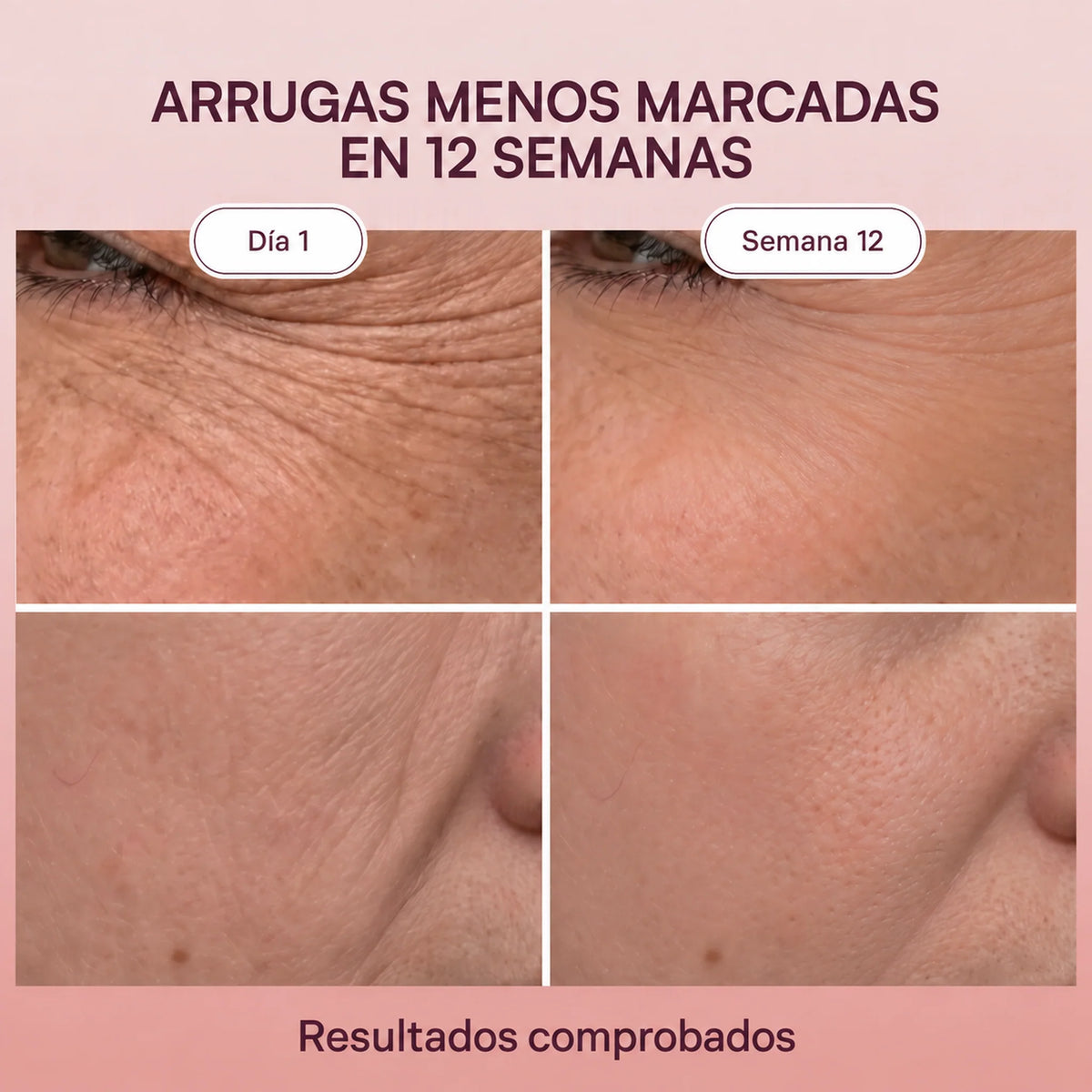 Arrugas menos marcadas en 12 semanas